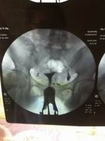 2026保定正规靠谱助孕公司名单大全：一共介绍前十家