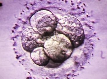 2026国内试管助孕成功率有多少？哪些因素会影响试管助孕成功率